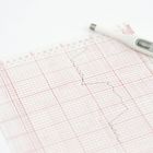 Фото: Базальная температура при бесплодии